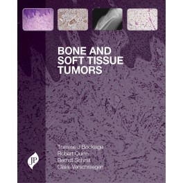 Bone and Soft Tissue Tumors