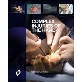 Complex Injuries of the Hand