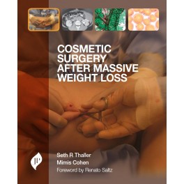 Cosmetic Surgery after Massive Weight Loss