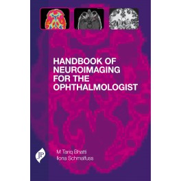 Handbook of Neuro-Imaging for the Ophthalmologist