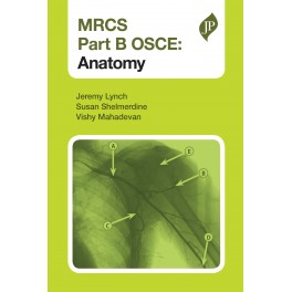 MRCS Part B OSCE