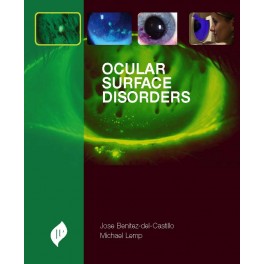 Ocular Surface Disorders